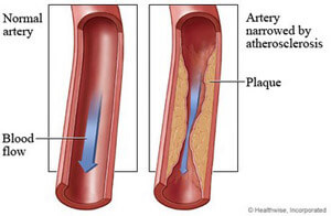 Arteries image